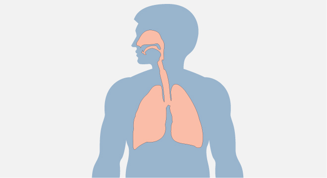 Tuberkulose: hochansteckende Erkrankung der Lungen durch den Tuberkelbazillus