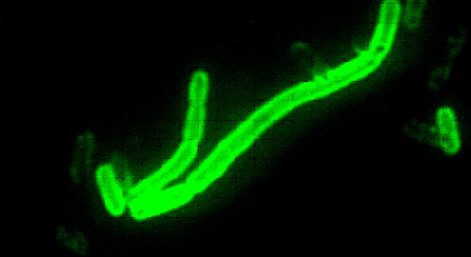 Pest: hochansteckende Infektionskrankheit durch das Bakterium Yersinia pestis
