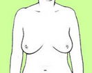 Item 1