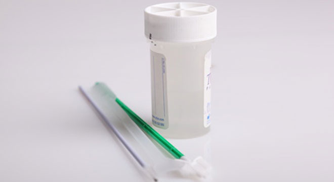 Sputumuntersuchung: Untersuchung von abgehustetem Bronchialsekret