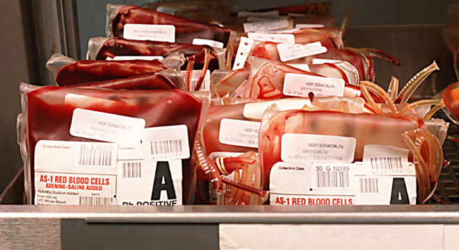 Bei schwerer Anämie sind Bluttransfusionen notwendig.