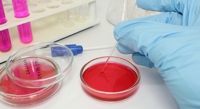 Epiglottitis: Infektion durch das Bakterium Haemophilus influenza Typ b