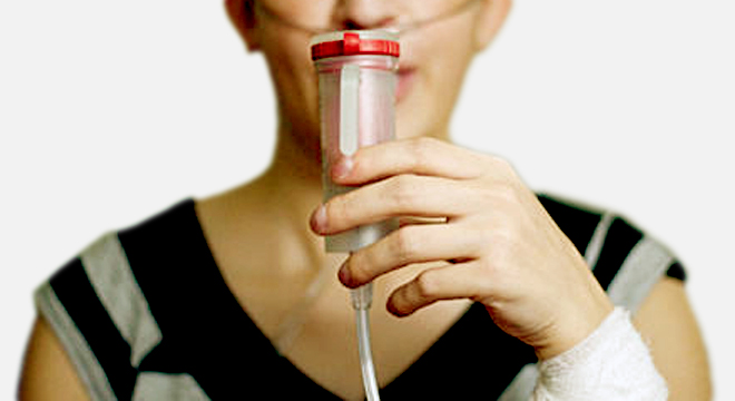 Cystische Fibrose: Chronischer schleimiger Husten