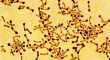 Diphtherie: Bakterium Corynebacterium diphtheriae