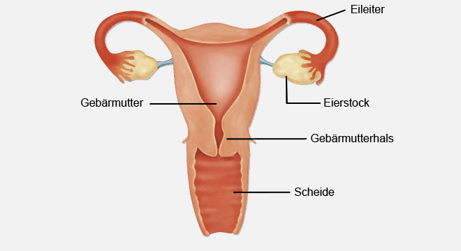 Endometriose: Verschleppte Zellen der Gebärmutterschleimhaut