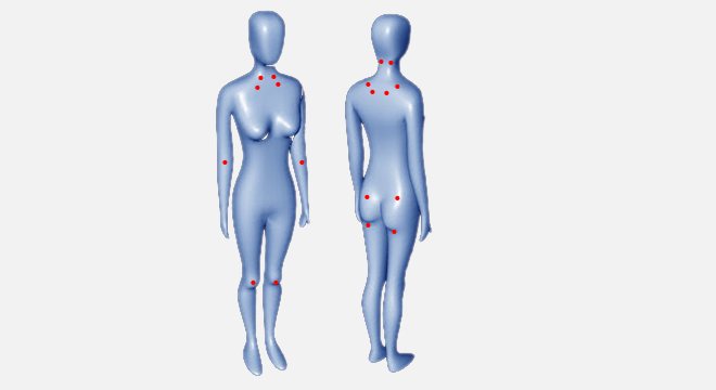 Fibromyalgie: chronische schmerzhafte nicht-entzündliche Erkrankung