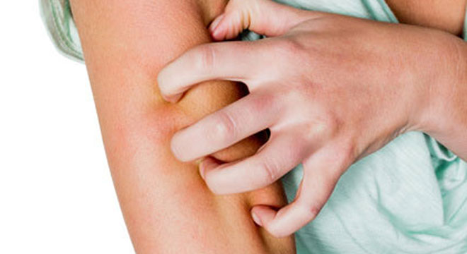 Hautausschlag kann auf eine entzündliche, infektiöse oder allergische Rekation sein