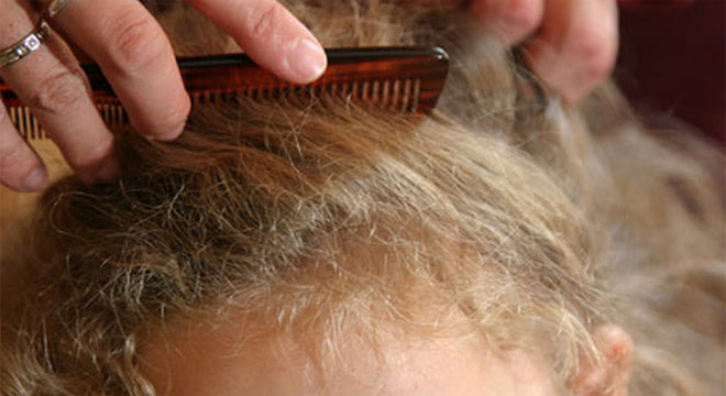 Kopfläuse, Filzläuse: weit verbreitet und haben nichts mit Hygienemangel zu tun