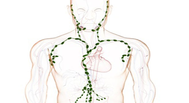 Lymphangitis: Entzündung der Lymphbahnen