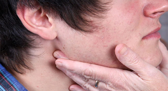 Lymphknotenschwellung sind häufig bei Infektionen wie Halsschmerzen oder bei Grippe