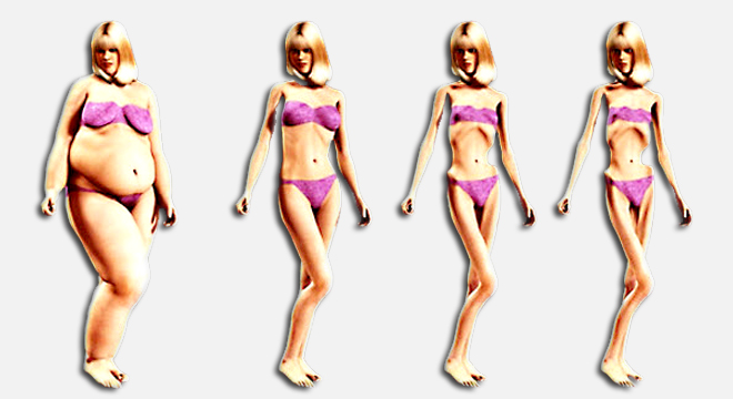 Anorexia nervosa: gestörte Körperwahrnehmung bei Magersucht